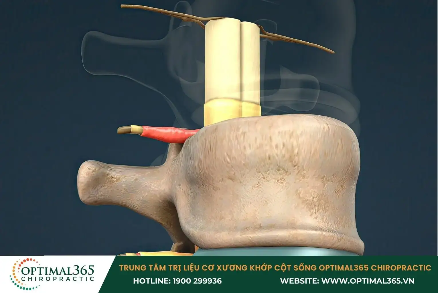 Tổn thương tủy sống có thể do té ngã, tai nạn giao thông, tai nạn công việc Tổn thương tủy sống có thể do té ngã, tai nạn giao thông, tai nạn công việc