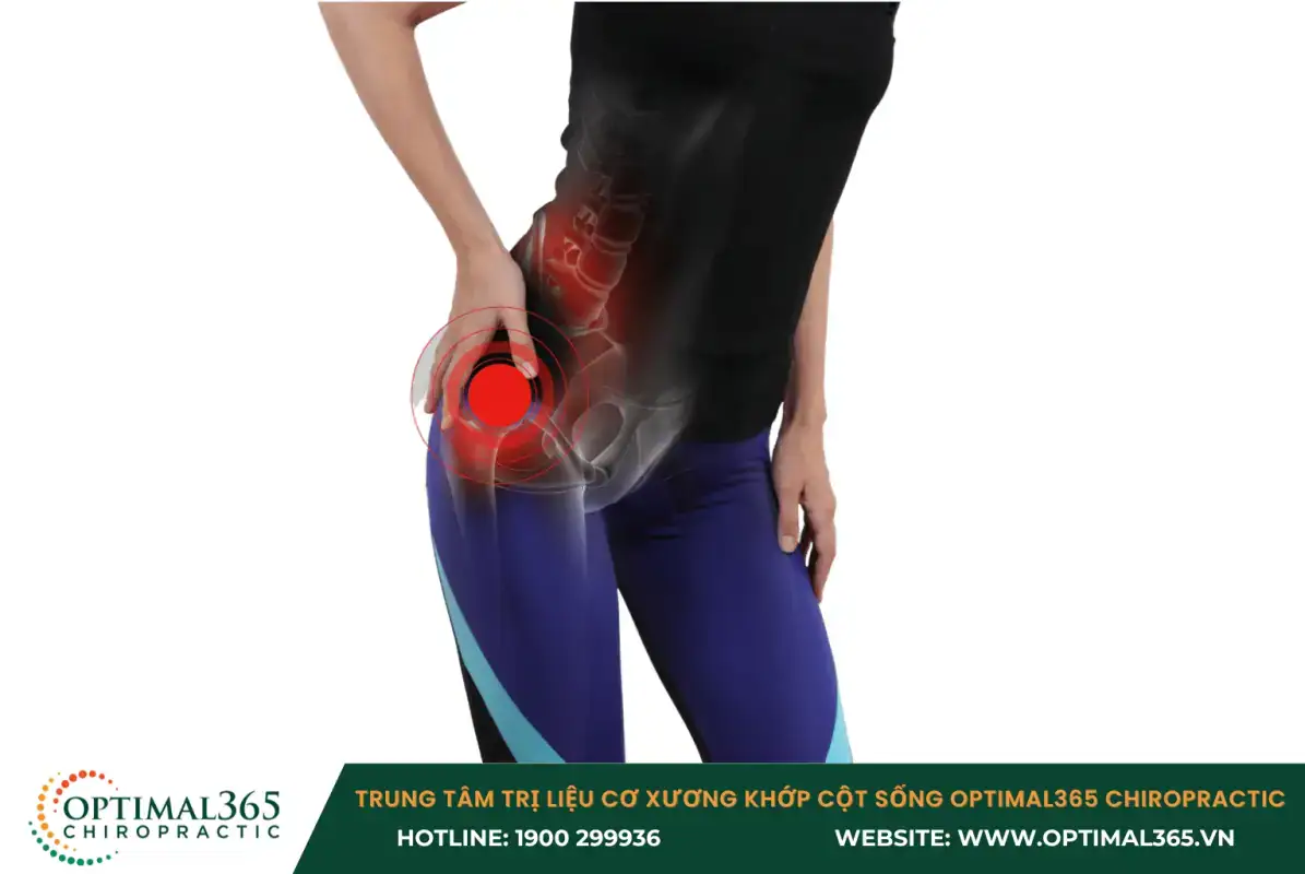 Đau nhức khớp háng có thể do các bệnh về xương khớp Đau nhức khớp háng có thể do các bệnh về xương khớp
