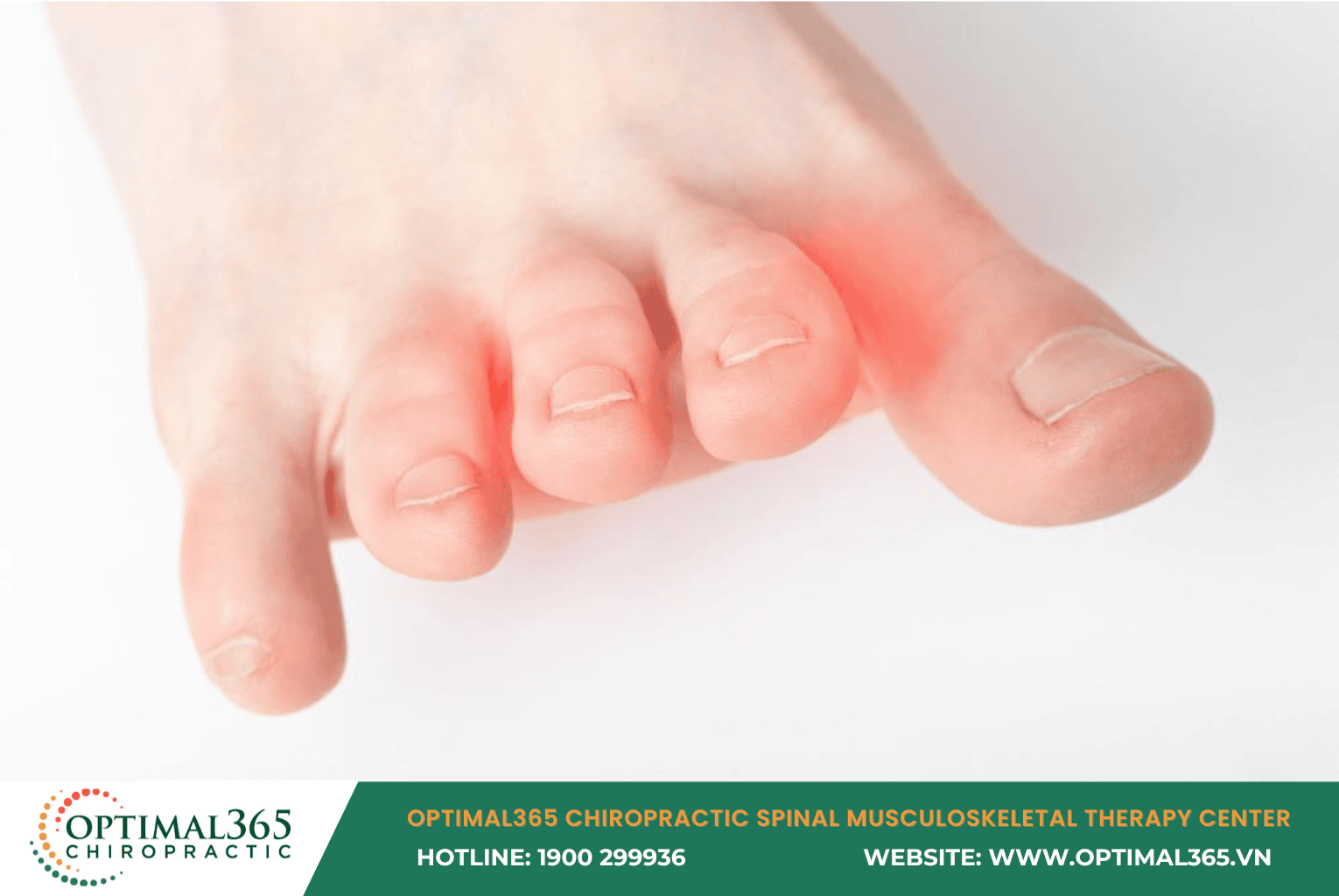 Toe cramp